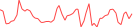 Sparkline Img