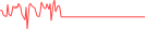 Sparkline Img
