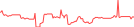 Sparkline Img