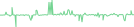 Sparkline Img
