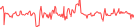 Sparkline Img