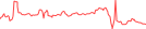 Sparkline Img