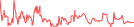 Sparkline Img