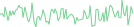 Sparkline Img