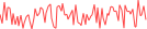 Sparkline Img