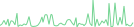 Sparkline Img