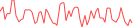 Sparkline Img
