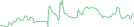 Sparkline Img