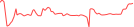 Sparkline Img