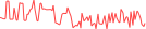 Sparkline Img