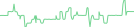 Sparkline Img