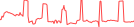 Sparkline Img