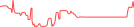 Sparkline Img