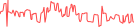 Sparkline Img