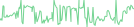 Sparkline Img