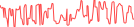 Sparkline Img