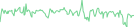 Sparkline Img