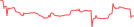 Sparkline Img