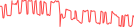 Sparkline Img